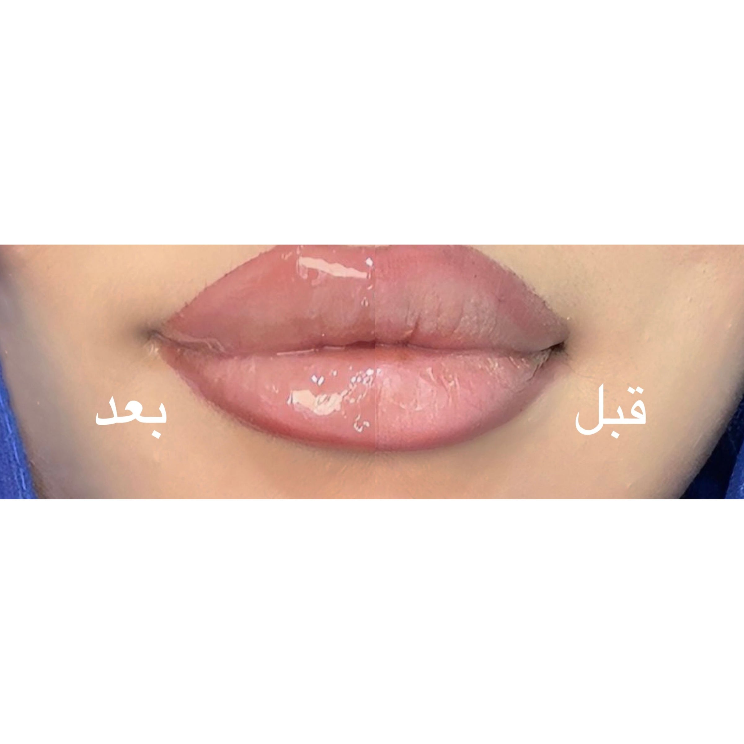 Dewy Lips Lip Oil Clear