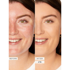 TARTE - Shape Tape™ Full-Coverage Concealer @ خافي العيوب مطفي
