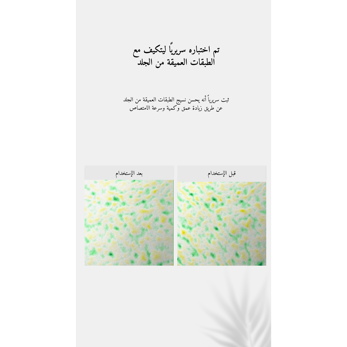 VT Reedle Shot 700 @ سيروم الوجه