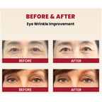 KSECRET SEOUL 1988 Eye Cream : Retinal Liposome 4% + Fermented Bean