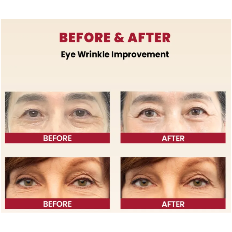 KSECRET SEOUL 1988 Eye Cream : Retinal Liposome 4% + Fermented Bean