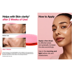 Anua - Niacinamide 10 TXA 4 Serum (Version 2025) سيروم