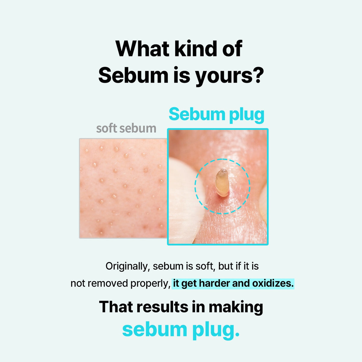 ilso Super Melting Sebum Softener @ محلول منعم ومنظف للمسام