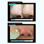 ilso Super Melting Sebum Softener @ محلول منعم ومنظف للمسام