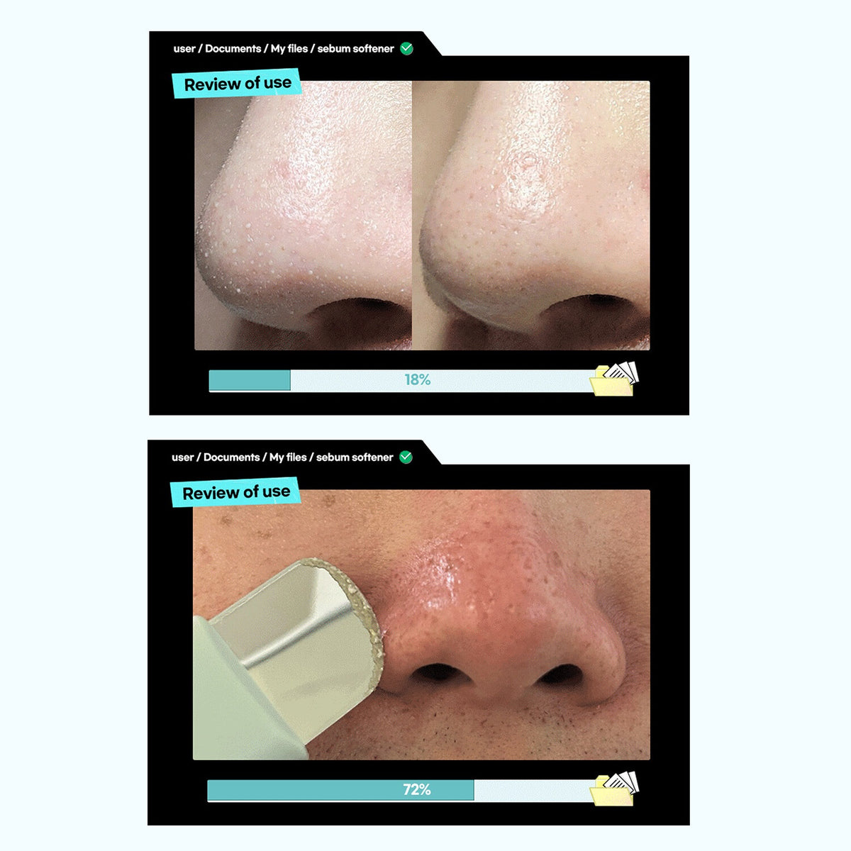 ilso Super Melting Sebum Softener @ محلول منعم ومنظف للمسام