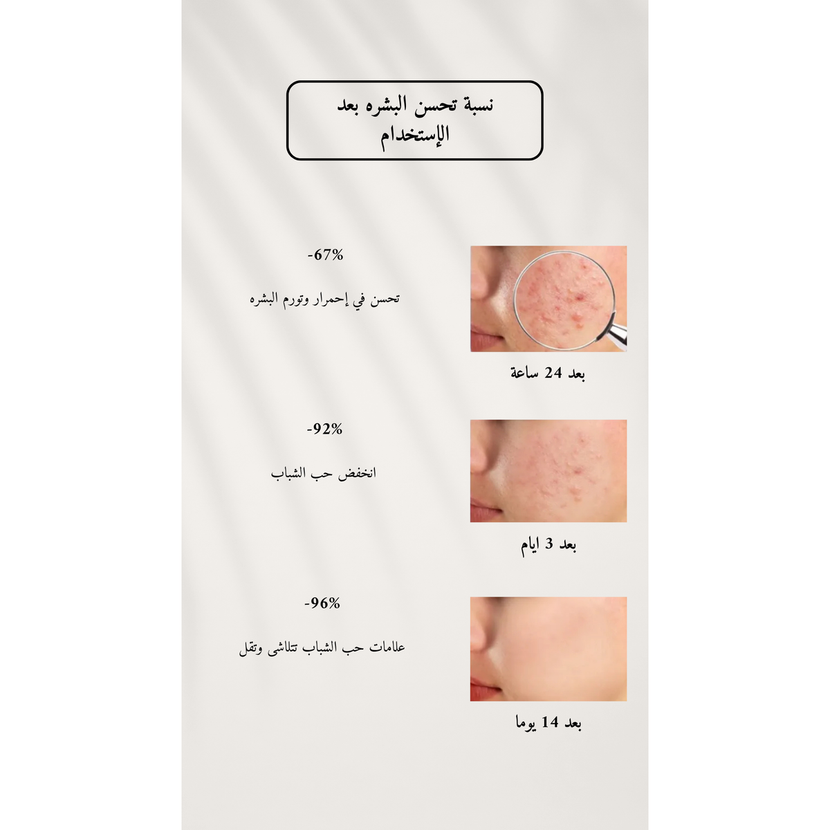 LION Pair Acne Cream W @ كريم معالجة الحبوب