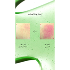 ANUA - Azelaic Acid 10 Hyaluron Redness Soothing Serum @ سيروم حمض الأزليك لتهدئة الإحمرار