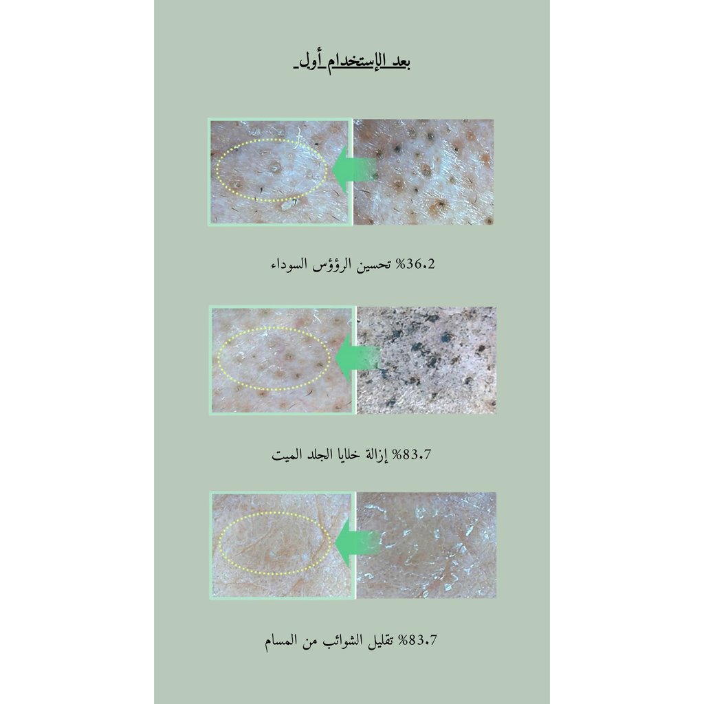 ilso Natural Mild Cleansing Oil @ مزيل المكياج زيتي