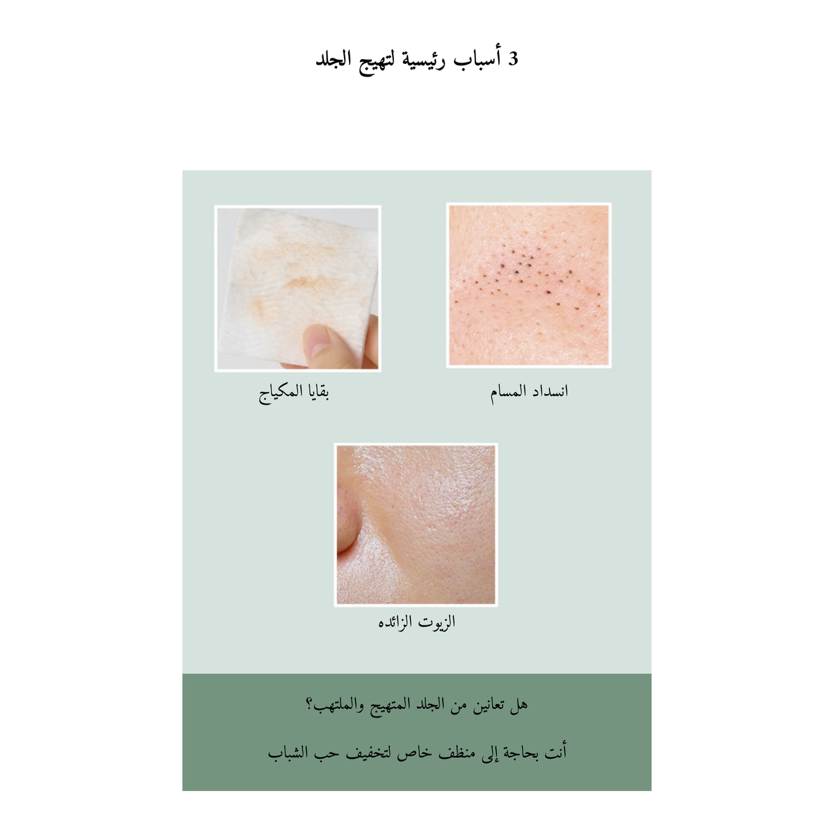 SKIN 1004 - Tea Trica BHA Foam 125ml @ غسول رغوي