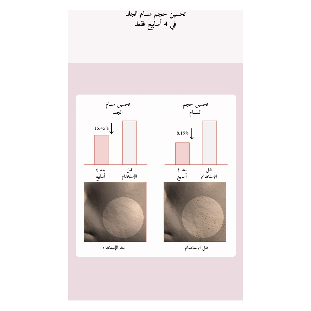 SKIN1004 Poremizing Clear Toner @ تونر الوجه