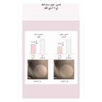 SKIN1004 Poremizing Clear Toner @ تونر الوجه