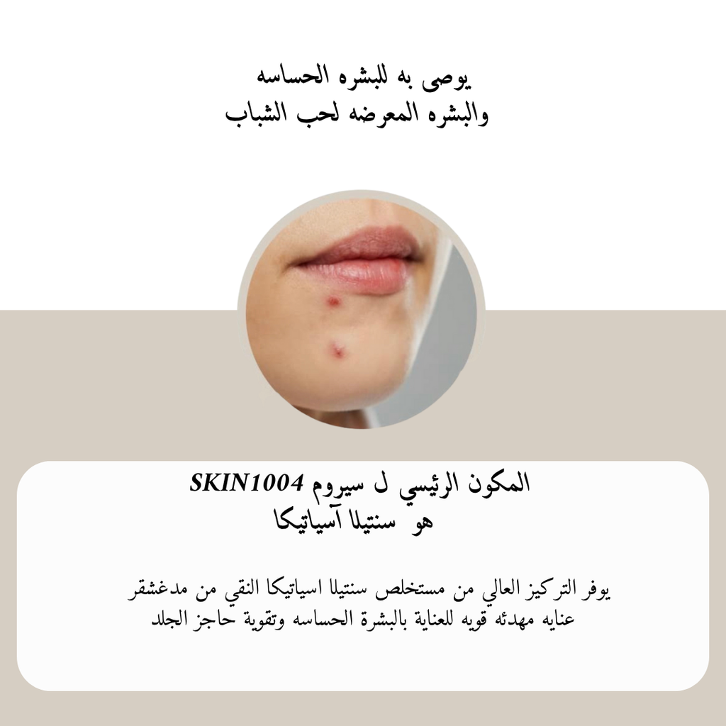 SKIN1004 Madagascar Centella Ampoule @ امبيول للوجه