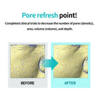 ilso Moringa Tightening Pore Serum @ سيروم المسام