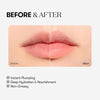 VT - Reedle Shot Lip Plumper Beginner