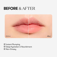 VT - Reedle Shot Lip Plumper Beginner