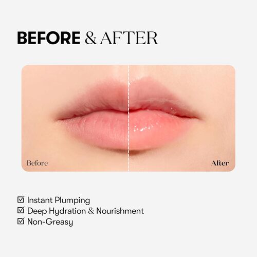 VT - Reedle Shot Lip Plumper Beginner