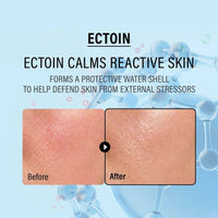 epii - Double Up Cream Ectoin & Panthenol