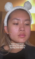 SKIN1004 Madagascar Centella Ampoule @ امبيول للوجه
