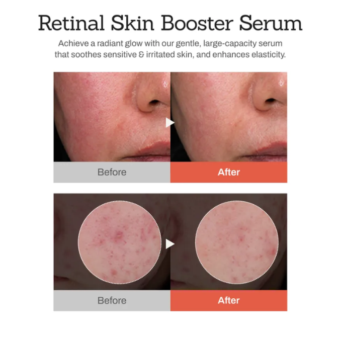 Meditherapy - Retinal Skin Booster Serum